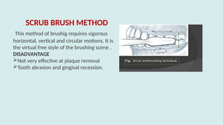 SCRUB BRUSH METHOD
This method of brushig requires vigorous
horizontal, vertical and circular motions. It is
the virtual free style of the brushing scene .
DISADVANTAGE
Not very effective at plaque removal
Tooth abrasion and gingival recession.
 