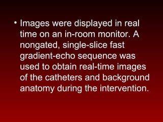 • Images were displayed in real
time on an in-room monitor. A
nongated, single-slice fast
gradient-echo sequence was
used to obtain real-time images
of the catheters and background
anatomy during the intervention.
 