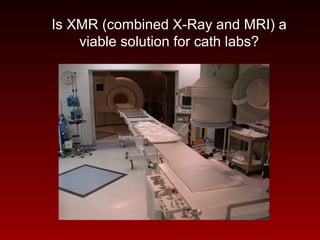 Is XMR (combined X-Ray and MRI) a
viable solution for cath labs?
 