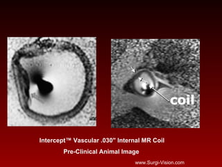 Intercept™ Vascular .030" Internal MR Coil
Pre-Clinical Animal Image
www.Surgi-Vision.com
 