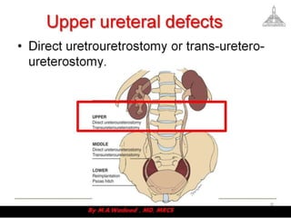 Upper urinary tract reconstruction | PDF