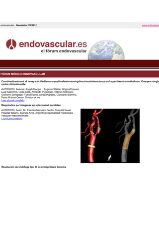 endovascular - Newsletter VII/2012                                                                                    www.endovascul




FÓRUM MÉDICO ENDOVASCULAR

Combinedtreatment of heavy calcifiedfemoro-popliteallesionsusingdirectionalatherectomy and a paclitaxelcoatedballoon: One-year single
centre clinicalresults.

AUTOR(ES): Autores: AngeloCioppa⁎ Eugenio Stabile, GrigorePopusoi,
                                      ,
Luigi Salemme, Linda Cota, Armando Pucciarelli, Vittorio Ambrosini,
Giovanni Sorropago, TullioTesorio, AlessiaAgresta, Giancarlo Biamino,
Paolo Rubino Centro: Division of Inv
Leer el post completo.

Diagnóstico por imágenes en enfermedad carotídea

AUTOR(ES): Autor: Dr. Esteban Mendaro Centro: Hospital Naval,
Hospital Italiano, Buenos Aires, Argentina Especialidad: Radiología
Vascular Intervencionista
Leer el post completo.




Resolución de endofuga tipo III en endoprótesis torácica
 