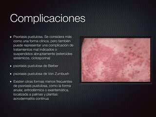 Psoriasis pustulosa. Se considera más
como una forma clínica, pero también
puede representar una complicación de
tratamientos mal indicados o
suspendidos abruptamente (esteroides
sistémicos, ciclosporina)
psoriasis pustulosa de Barber
psoriasis pustulosa de Von Zumbush
Existen otras formas menos frecuentes
de psoriasis pustulosa, como la forma
anular, eritrodérmica o exantemática,
localizada a palmas y plantas:
acrodermatitis continua
Complicaciones
 