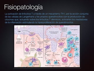 Fisiopatología
La activación de linfocitos T a través de un mecanismo Th1, por la acción conjunta
de las células de Langerhans y los propios queratinocitos con la producción de
citocinas que, actuando sobre los linfocitos T dérmicos, activarían los mediadores
de la inﬂamación estimulando la hiperproliferación de queratinocitos
 