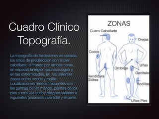 Cuadro Clínico
Topografía.
La topografía de las lesiones es variada,
los sitios de predilección son la piel
cabelluda; el tronco por ambas caras,
en especial la región sacrococcígea y
en las extremidades, en las salientes
óseas como codos y rodilla.
Localizaciones menos frecuentes son
las palmas de las manos, plantas de los
pies y rara vez en los pliegues axilares e
inguinales (psoriasis invertida) y el pene.
 
