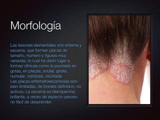Morfología
Las lesiones elementales son eritema y
escama, que forman placas de
tamaño, número y ﬁguras muy
variadas, lo cual ha dado lugar a
formas clínicas como la psoriasis en
gotas, en placas, anular, girata,
numular, ostrácea, circinada
Las placas eritematoescamosas son
bien limitadas, de bordes deﬁnidos, no
activos. La escama es blanquecina,
brillante, a veces de aspecto yesoso,
no fácil de desprender.
 