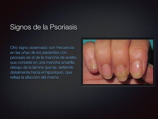 Otro signo observado con frecuencia
en las uñas de los pacientes con
psoriasis es el de la mancha de aceite,
que consiste en una mancha amarilla
debajo de la lámina que se extiende
distalmente hacia el hiponiquio, que
reﬂeja la afección del mismo
Signos de la Psoriasis
 