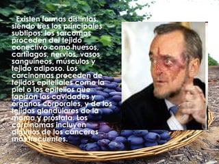 Existen formas distintas, siendo tres los principales subtipos: los sarcomas proceden del tejido conectivo como huesos, cartílagos, nervios, vasos sanguíneos, músculos y tejido adiposo. Los carcinomas proceden de tejidos epiteliales como la piel o los epitelios que tapizan las cavidades y órganos corporales, y de los tejidos glandulares de la mama y próstata. Los carcinomas incluyen algunos de los cánceres más frecuentes.   
