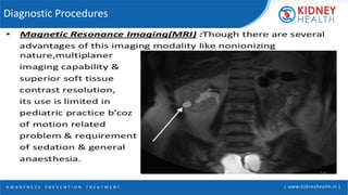 A W A R E N E S S | P R E V E N T I O N | T R E A T M E N T | www.kidneyhealth.in |
Diagnostic Procedures
 