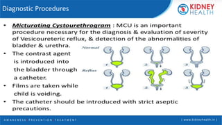 A W A R E N E S S | P R E V E N T I O N | T R E A T M E N T | www.kidneyhealth.in |
Diagnostic Procedures
 