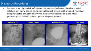 A W A R E N E S S | P R E V E N T I O N | T R E A T M E N T | www.kidneyhealth.in |
Diagnostic Procedures
 