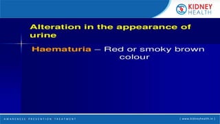 A W A R E N E S S | P R E V E N T I O N | T R E A T M E N T | www.kidneyhealth.in |
 