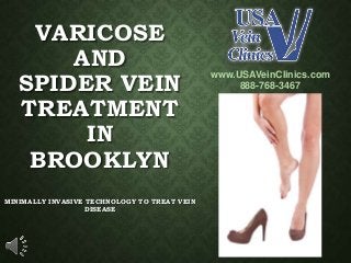 VARICOSE
AND
SPIDER VEIN
TREATMENT
IN
BROOKLYN
MINIMALLY INVASIVE TECHNOLOGY TO TREAT VEIN
DISEASE
www.USAVeinClinics.com
888-768-3467
 