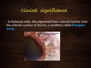 Anatomy and physiology of Uvea- Dr. Moks.pptx