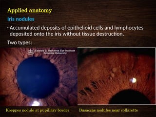 Anatomy and physiology of Uvea- Dr. Moks.pptx