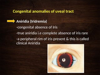 Anatomy and physiology of Uvea- Dr. Moks.pptx