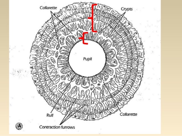 uveal tract