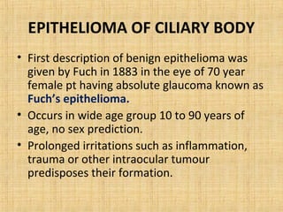 EPITHELIOMA OF CILIARY BODY
• First description of benign epithelioma was
  given by Fuch in 1883 in the eye of 70 year
  female pt having absolute glaucoma known as
  Fuch’s epithelioma.
• Occurs in wide age group 10 to 90 years of
  age, no sex prediction.
• Prolonged irritations such as inflammation,
  trauma or other intraocular tumour
  predisposes their formation.
 