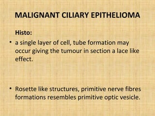 MALIGNANT CILIARY EPITHELIOMA
  Histo:
• a single layer of cell, tube formation may
  occur giving the tumour in section a lace like
  effect.



• Rosette like structures, primitive nerve fibres
  formations resembles primitive optic vesicle.
 