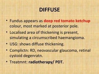 DIFFUSE
• Fundus appears as deep red tomato ketchup
  colour, most marked at posterior pole.
• Localised area of thickening is present,
  simulating a circumscribed haemangioma.
• USG: shows diffuse thickening.
• Complictn: RD, neovascular glaucoma, retinal
  cystoid degenratn.
• Treatmnt: radiotherapy/ PDT.
 