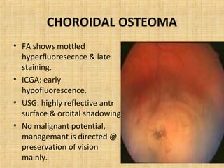 CHOROIDAL OSTEOMA
• FA shows mottled
  hyperfluoresecnce & late
  staining.
• ICGA: early
  hypofluorescence.
• USG: highly reflective antr
  surface & orbital shadowing.
• No malignant potential,
  managemant is directed @
  preservation of vision
  mainly.
 