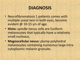 DIAGNOSIS
• Neurofibromatosis 1 patients comes with
  multiple uveal nevi in both eyes, become
  evident @ 10-15 yrs of age.
• Histo: spindle nevus cells are fusiform
  melanocytes that typically have a relatively
  small nucleaus.
• Magnocellular nevus: plump polyhedral
  melanocytes containing numerous large intra
  cytoplasmic melanin granules.
 