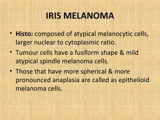 IRIS MELANOMA
• Histo: composed of atypical melanocytic cells,
  larger nuclear to cytoplasmic ratio.
• Tumour cells have a fusiform shape & mild
  atypical spindle melanoma cells.
• Those that have more spherical & more
  pronounced anaplasia are called as epithelioid
  melanoma cells.
 