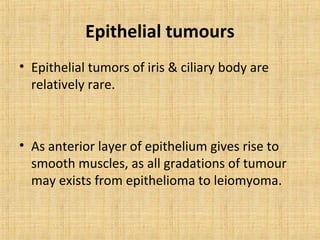 Epithelial tumours
• Epithelial tumors of iris & ciliary body are
  relatively rare.



• As anterior layer of epithelium gives rise to
  smooth muscles, as all gradations of tumour
  may exists from epithelioma to leiomyoma.
 