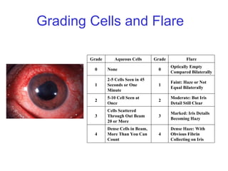 Grading Cells and Flare  Dense Haze: With Obvious Fibrin Collecting on Iris 4 Dense Cells in Beam, More Than You Can Count 4 Marked: Iris Details Becoming Hazy 3 Cells Scattered Through Out Beam 20 or More 3 Moderate: But Iris Detail Still Clear 2 5-10 Cell Seen at Once 2 Faint: Haze or Not Equal Bilaterally 1 2-5 Cells Seen in 45 Seconds or One Minute 1 Optically Empty Compared Bilaterally 0 None 0 Flare Grade Aqueous Cells Grade 