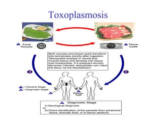 Toxoplasmosis 