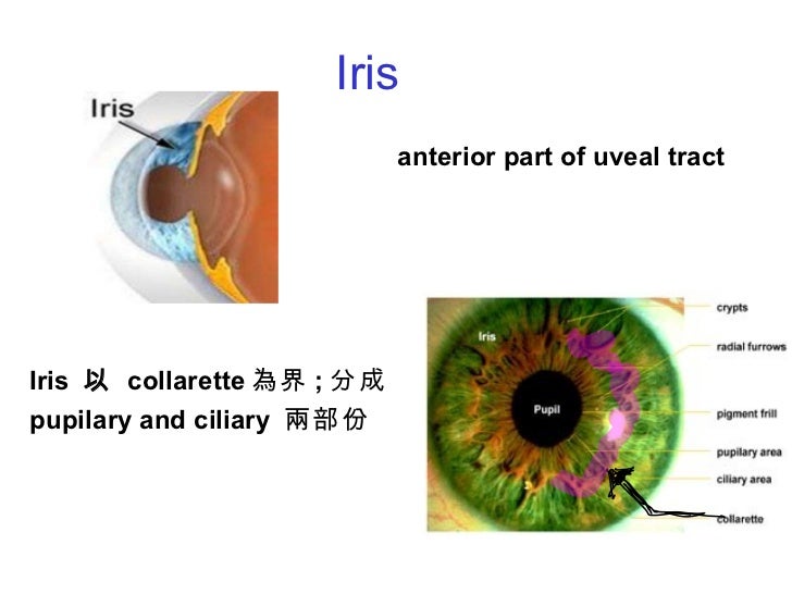uveal tract