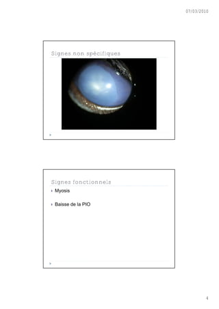 07/03/2010




Signes non spécifiques




Signes fonctionnels
   Myosis

   Baisse de la PIO




                                 4
 
