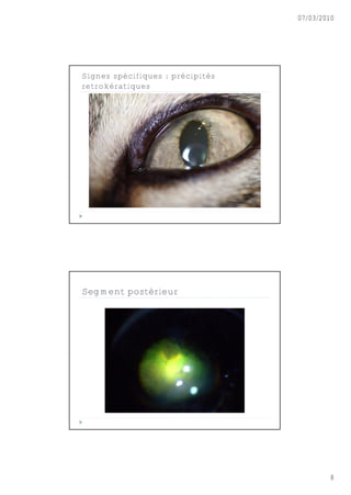 07/03/2010




Signes spécifiques : précipités
retrokératiques




Segment postérieur




                                          8
 
