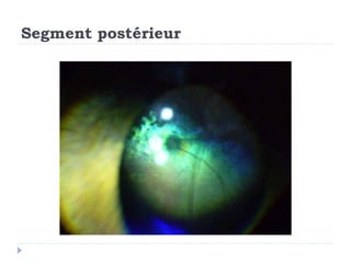Segment postérieur
 