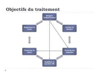 Objectifs du traitement
Stopper
l’inflammation
Limiter la
douleur
Prévenir les
séquelles
Stabiliser la
barrière HA
Préserver la
vision
Supprimer la
cause
 