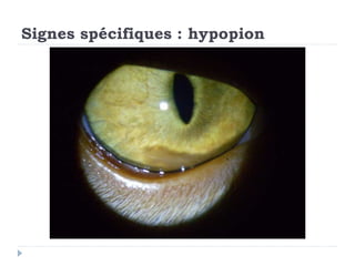 Signes spécifiques : hypopion
 