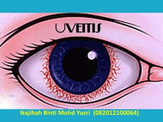 Najihah Binti Mohd Yusri (082012100064)
 