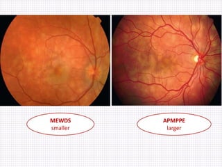 MEWDS
smaller
APMPPE
larger
 