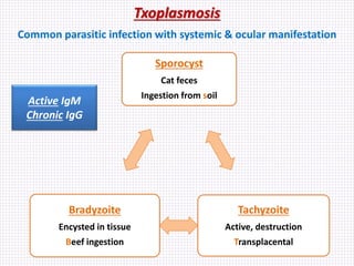 Txoplasmosis
Common parasitic infection with systemic & ocular manifestation
Sporocyst
Cat feces
Ingestion from soil
Tachyzoite
Active, destruction
Transplacental
Bradyzoite
Encysted in tissue
Beef ingestion
Active IgM
Chronic IgG
 