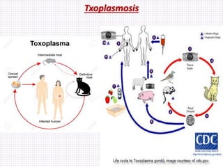 Txoplasmosis
 