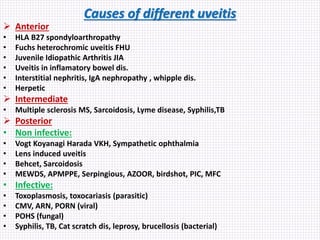 Causes of different uveitis
 Anterior
• HLA B27 spondyloarthropathy
• Fuchs heterochromic uveitis FHU
• Juvenile Idiopathic Arthritis JIA
• Uveitis in inflamatory bowel dis.
• Interstitial nephritis, IgA nephropathy , whipple dis.
• Herpetic
 Intermediate
• Multiple sclerosis MS, Sarcoidosis, Lyme disease, Syphilis,TB
 Posterior
• Non infective:
• Vogt Koyanagi Harada VKH, Sympathetic ophthalmia
• Lens induced uveitis
• Behcet, Sarcoidosis
• MEWDS, APMPPE, Serpingious, AZOOR, birdshot, PIC, MFC
• Infective:
• Toxoplasmosis, toxocariasis (parasitic)
• CMV, ARN, PORN (viral)
• POHS (fungal)
• Syphilis, TB, Cat scratch dis, leprosy, brucellosis (bacterial)
 