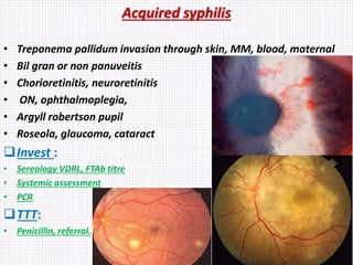 Acquired syphilis
• Treponema pallidum invasion through skin, MM, blood, maternal
• Bil gran or non panuveitis
• Chorioretinitis, neuroretinitis
• ON, ophthalmoplegia,
• Argyll robertson pupil
• Roseola, glaucoma, cataract
Invest :
• Sereology VDRL, FTAb titre
• Systemic assessment
• PCR
TTT:
• Penicillin, referral.
 