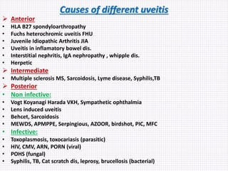 Causes of different uveitis
 Anterior
• HLA B27 spondyloarthropathy
• Fuchs heterochromic uveitis FHU
• Juvenile Idiopathic Arthritis JIA
• Uveitis in inflamatory bowel dis.
• Interstitial nephritis, IgA nephropathy , whipple dis.
• Herpetic
 Intermediate
• Multiple sclerosis MS, Sarcoidosis, Lyme disease, Syphilis,TB
 Posterior
• Non infective:
• Vogt Koyanagi Harada VKH, Sympathetic ophthalmia
• Lens induced uveitis
• Behcet, Sarcoidosis
• MEWDS, APMPPE, Serpingious, AZOOR, birdshot, PIC, MFC
• Infective:
• Toxoplasmosis, toxocariasis (parasitic)
• HIV, CMV, ARN, PORN (viral)
• POHS (fungal)
• Syphilis, TB, Cat scratch dis, leprosy, brucellosis (bacterial)
 