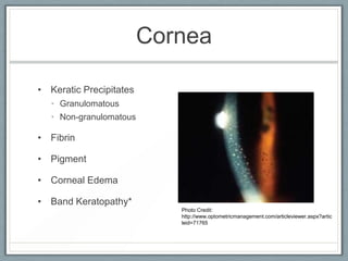 UVEITIS | PDF