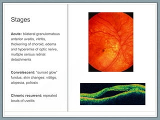 UVEITIS | PDF