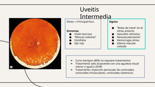 Uveitis
Intermedia
Vitreo Principal foco.
→
Sìntomas
● Visiòn borrosa
● “Moscas volantes”
● Fotofobia
● Ojo rojo
Signos
● “Bolas de nieve” en el
vítreo anterior.
● Vasculitis retiniana.
● Neovascularizaciòn
● Hemorragia vitrea.
● Edema macular
cistoide
➔ Curso benigno (80% no requiere tratamiento)
➔ Tratamiento solo al paciente con una agudeza visual
menor o igual a 20/40
➔ Tratamiento: Inyección periocular de corticoides,
corticoides intraoculares, corticoides sistemicos
 