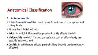 classification of uveitis and any uveitis | PPTX