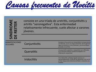 SINDROME	
  
DE	
  REITER	
  	
  
consiste	
  en	
  una	
  tríada	
  de	
  uretri@s,	
  conjun@vi@s	
  y	
  
artri@s	
  “seronega@va”.	
  Esta	
  enfermedad	
  
rela@vamente	
  infrecuente,	
  suele	
  afectar	
  a	
  varones	
  
jóvenes.	
  
MANIFESTACIONES	
  
OCULARES	
   Conjun@vi@s	
  	
  
Aunque	
  es	
  frecuente	
  una	
  conjun@vi@s	
  mucopurulenta	
  
sin	
  folículos,	
  no	
  es	
  un	
  rango	
  constante.	
  Por	
  lo	
  general,	
  
sigue	
  la	
  uretri@s	
  en	
  unas	
  semanas	
  y,	
  de	
  forma	
  lpica,	
  
precede	
  a	
  la	
  artri@s.	
  
Quera@@s	
  
Una	
  quera@@s	
  epitelial	
  o	
  subepitelial	
  con	
  inﬁltrados	
  
en	
  la	
  estroma	
  anterior	
  puede	
  acompañar	
  a	
  la	
  
inﬂamación	
  conjun@val.	
  
Iridocili@s	
  
Una	
  iridocicli@s	
  unilateral	
  aguda	
  aparece	
  en	
  
aproximadamente	
  el	
  20%	
  de	
  los	
  pacientes,	
  sea	
  con	
  el	
  
primer	
  ataque	
  del	
  síndrome	
  de	
  Reiter	
  o	
  durante	
  una	
  
recidiva.	
  
Causas frecuentes de Uveítis	
  
 