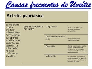 Artrias	
  psoriásica	
  
Es	
  una	
  artri@s	
  
erosiva,	
  
anodular,	
  
inﬂamatoria	
  y	
  
“seronega@va”	
  
que	
  aparece	
  
en	
  el	
  5%	
  de	
  los	
  
pacientes	
  con	
  
psoriasis.	
  La	
  
enfermedad	
  
no	
  @ene	
  
preferencias	
  
sexuales.	
  
MANIFESTACIONES	
  
OCULARES	
  
Conjun@vi@s	
   Alrededor	
  del	
  20%	
  de	
  los	
  
pacientes	
  desarrolla	
  
conjun@vi@s.	
  
Queratoconjun@vi@s	
  
seca	
   Es	
  una	
  complicación	
  
rela@vamente	
  rara.	
  
Quera@@s	
   Algunos	
  pacientes	
  con	
  uvei@s	
  
anterior	
  desarrollan	
  una	
  
elevación	
  de	
  los	
  inﬁltrados	
  
corneales	
  inmediatamente	
  por	
  
dentro	
  del	
  limbo.	
  
Iridocicli@s	
   Las	
  iridocicli@s	
  aparecen	
  con	
  
menor	
  frecuencia	
  en	
  la	
  artri@s	
  
psoriásica	
  que	
  en	
  la	
  EA	
  o	
  en	
  el	
  
síndrome	
  de	
  Reiter	
  
Causas frecuentes de Uveítis	
  
 