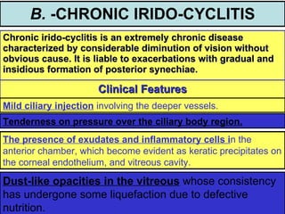 Uveitis 2lectures by dr. khaled | PPT